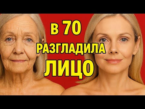 Видео: СОЛЬ+СОДА в 70 лет Мгновенно кожу лица сделала моложе на 20 лет ! МАСКА от морщин