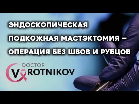 Видео: Эндоскопическая подкожная мастэктомия #москва #рмж #онкология 