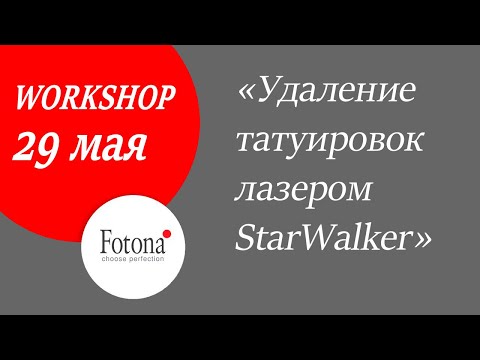 Видео: 29/05/2020 Удаление татуировок лазером StarWalker