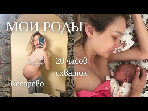 Видео: История моих родов | ВНЕПЛАНОВОЕ КЕСАРЕВО + 12 дней после