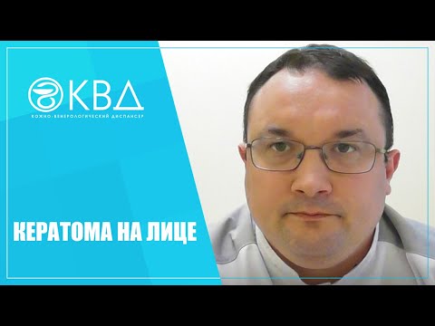 Видео: 1165  Кератома на лице