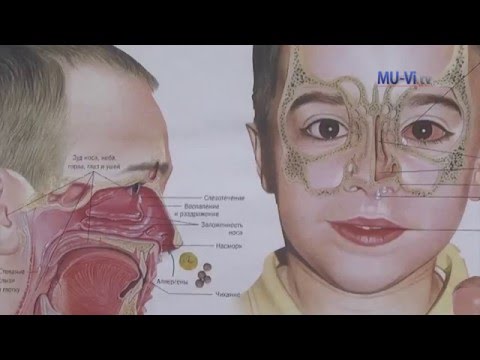 Видео: Сънна апнея