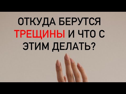 Видео: Трещина на ногтях и что с ними делать