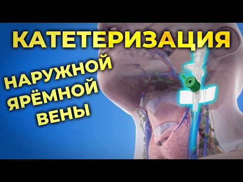 Видео: Катетеризация наружной ярёмной вены #ПроСМП