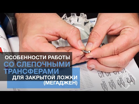 Видео: Особенности работы со слепочными трансферами для закрытой ложки (Мегаджен)