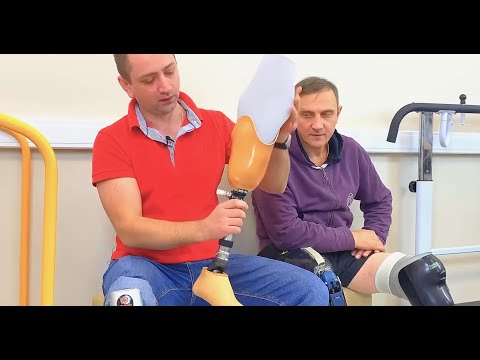 Видео: Всё о протезах ног. Часть 11: "Силиконовый чехол и крепление протеза".