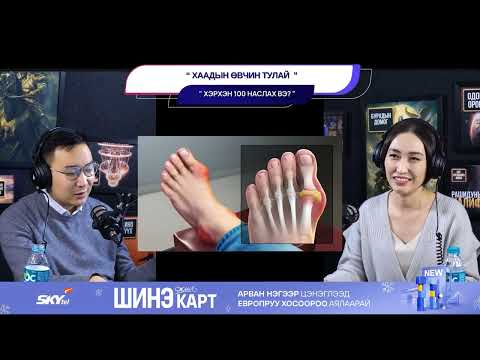 Видео: Хаадын өвчин тулай - ХЭРХЭН 100 НАСЛАХ ВЭ?