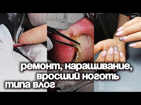 Видео: Ремонты, наращивание, вросшие ногти, отмена записи клиента - моё 1 сентября)