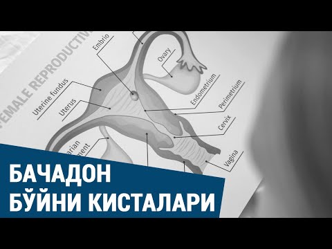 Видео: Бачадон бўйни кисталари: сабаблари, белгилари, аниқлаш ва даволаш
