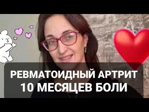 Видео: РЕВМАТОИДНЫЙ АРТРИТ # 2 |🖐️🤌 ДЕФОРМАЦИИ РУК | 🙄ЧТО ПОМОГАЕТ?