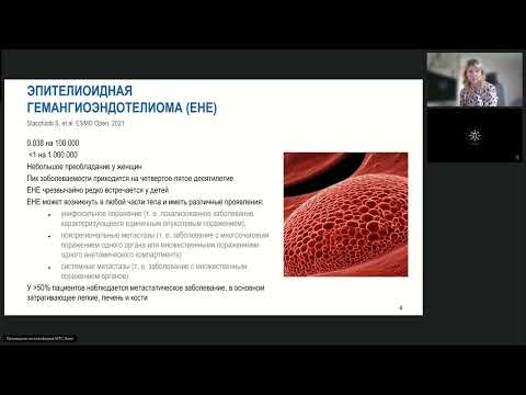 Видео: Редкие опухоли. Эпителиоидная гемангиоэндотелиома (вебинар 11 сентября 2024)