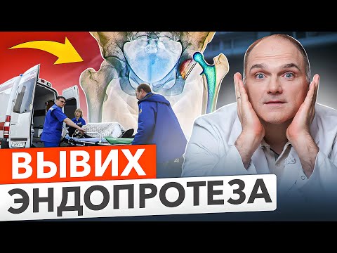 Видео: Вывих эндопротеза тазобедренного сустава. Как не допустить ужасных последствий.