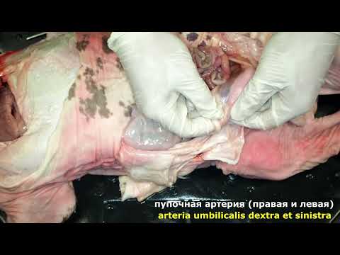 Видео: Пуповина (пупочный канатик)