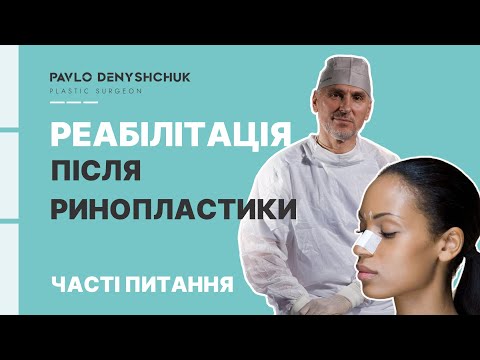 Видео: РЕАБІЛІТАЦІЯ ПІСЛЯ РИНОПЛАСТИКИ: ЧАСТІ ПИТАННЯ