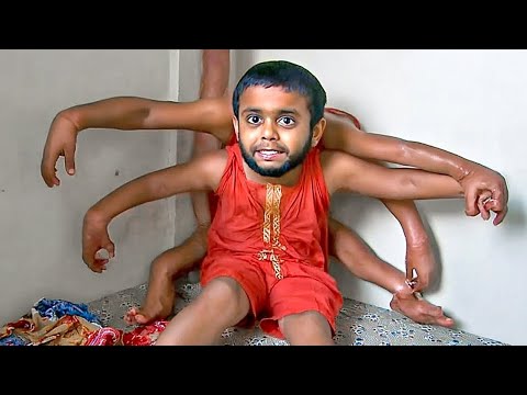 Видео: Откройте для себя 15 самых редких и необычных частей человеческого тела, обнаруженных в Индии 