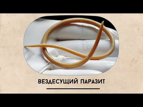Видео: Протравка аскарид!