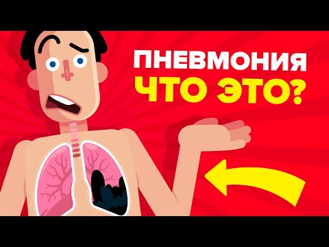Видео: Пневмония - объяснение.