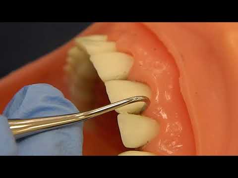 Видео: Как использовать серповидные скалеры