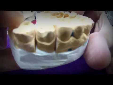 Видео: Цельно литая коронка..изготовление колпачка...моделирование!