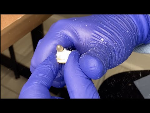 Видео: Изготовление единой временной коронки