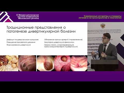 Видео: Кишечная микробиота как мишень терапии дивертикулярной болезни