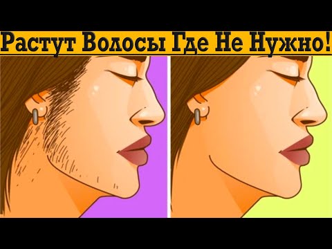 Видео: Растут Волосы Где Не Нужно!