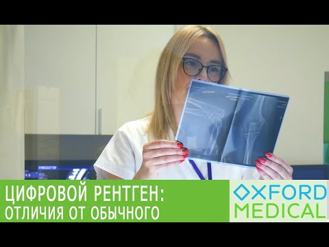Видео: ЦИФРОВОЙ РЕНТГЕН: чем отличается от обычного