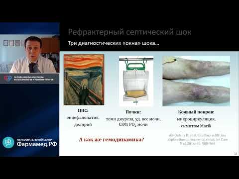 Видео: Рефрактерный септический шок Кузьков В.В.