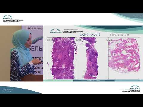 Видео: Исследование промежуточных биоптатов рака молочной железы