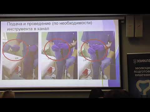 Видео: 16 Авдюгина АЛ Роль медицинской сестры в проведении эндоскопии