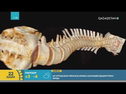 Видео: Сколиоз дертінің себебі мен емі қандай? | Назерке Бұрхан