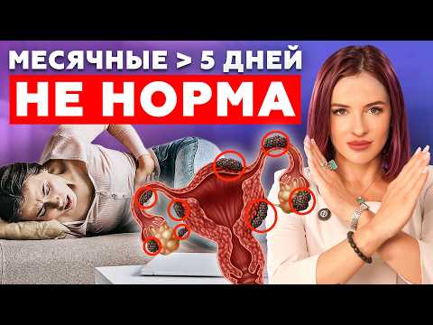 Видео: СКРЫТЫЕ признаки ЭНДОМЕТРИОЗА! Из-за этих ОШИБОК вы НЕ ДОЖИВЕТЕ до 50