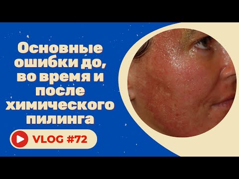 Видео: Основные ошибки до, во время и после химического пилинга