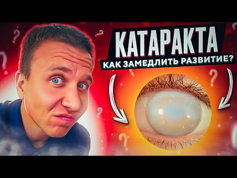 Видео: Причины развития катаракты и способы, чтобы замедлить помутнения хрусталика / Доктор Андрей Сорокин