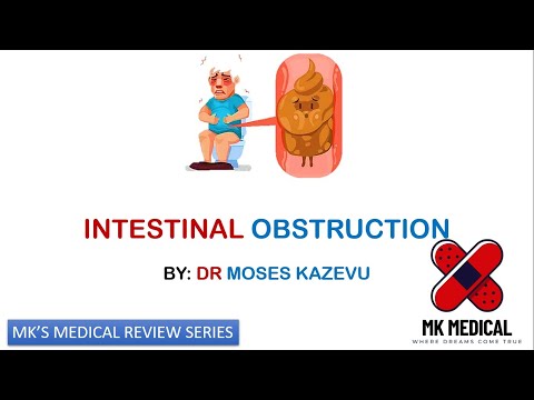 Видео: Кишечная непроходимость || IO