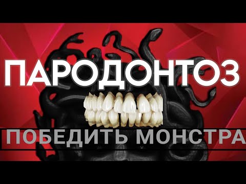 Видео: Как я вылечила парадонтоз у 1000 человек