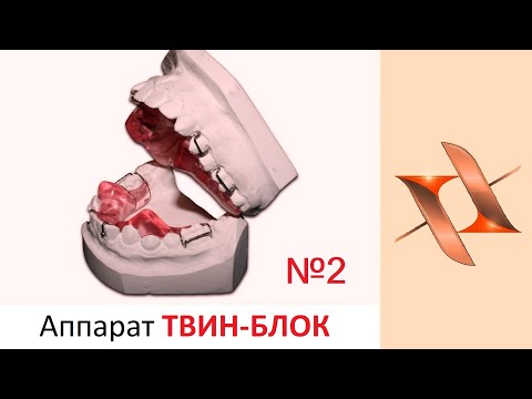 Видео: Функциональный аппарат Твин Блок - Twin Block. Часть 2. Ортодонтия.
