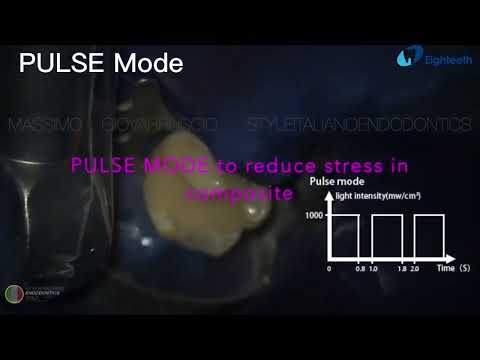 Видео: Полимеризационная лампа Curing Pen