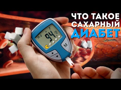 Видео: Что такое сахарный диабет? | Очень просто о сахарном диабете