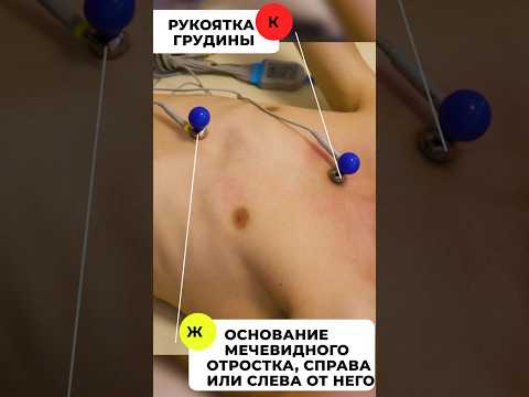 Видео: #экг #кардиолог #скораяпомощь #просмп
