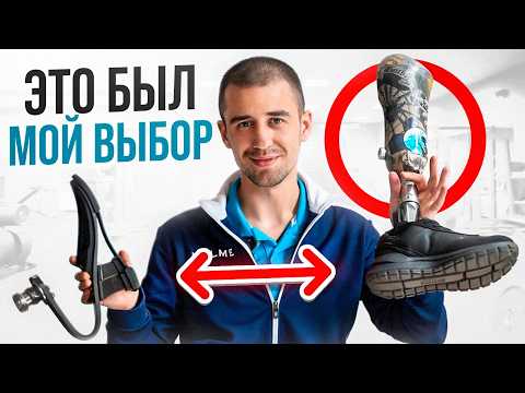 Видео: ЗАЧЕМ я согласился на вторую АМПУТАЦИЮ? Какие стопы я использую?