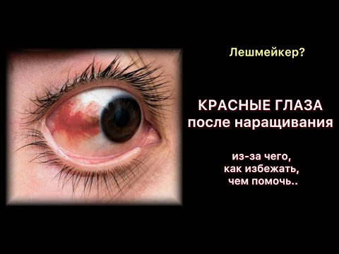 Видео: Из-ча чего, как не допустить, что делать если ..