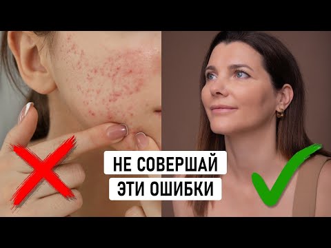 Видео: Какие ОШИБКИ ты допускаешь в уходе за кожей лица? ПРИВИЧКИ, которые портят твою кожу!