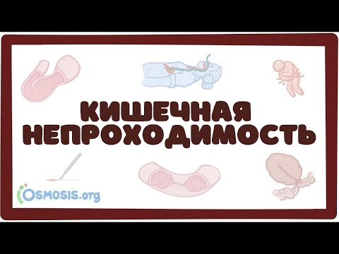 Видео: Острая кишечная непроходимость (хирургия лекция) Osmosis