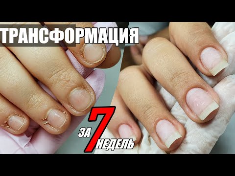Видео: ТРАНСФОРМАЦИЯ: идеальные ногти и кутикула за 7 недель