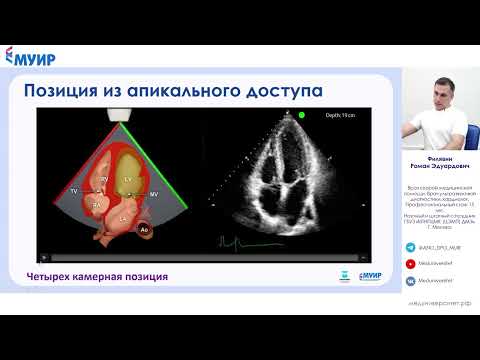 Видео: Фокусированная эхокардиография: кардио-диагностика нового уровня #узи #кардиолог #неотложка #врач