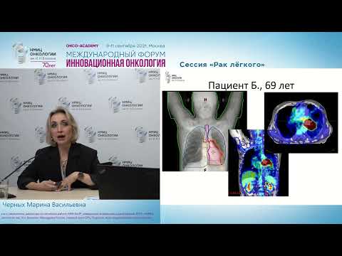 Видео: Роль лучевой терапии в лечении больных раком легкого.