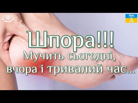 Видео: Шпора! Мучить сьогодні ,вчора і тривалий час...