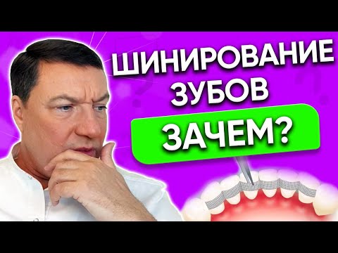Видео: Шинирование зубов ПРОВОЛОКОЙ или стекловолоконной ЛЕНТОЙ. РЕТЕЙНЕРЫ после брекетов.