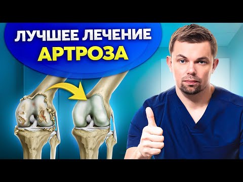 Видео: Убери боль в колене НАВСЕГДА. Как вылечить артроз в 2025 году?